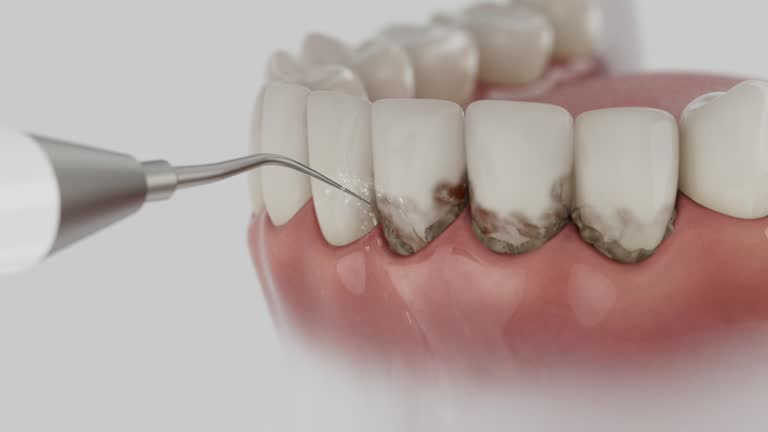 Trusted Tooth Extraction service in St. Johns, AZ - Dentist Open Now